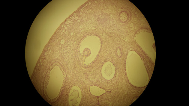 Ovary Graafian Follicle Slides - Ovary Graafian Follicle 004 100X